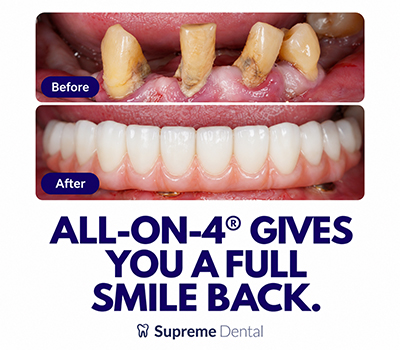 Supreme-Dental_Mobile-Banner_2
